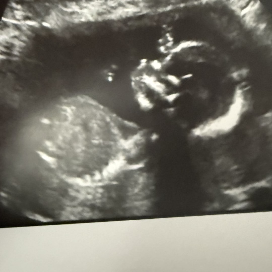 Photo shared by Arlette for their Babylist baby registry.