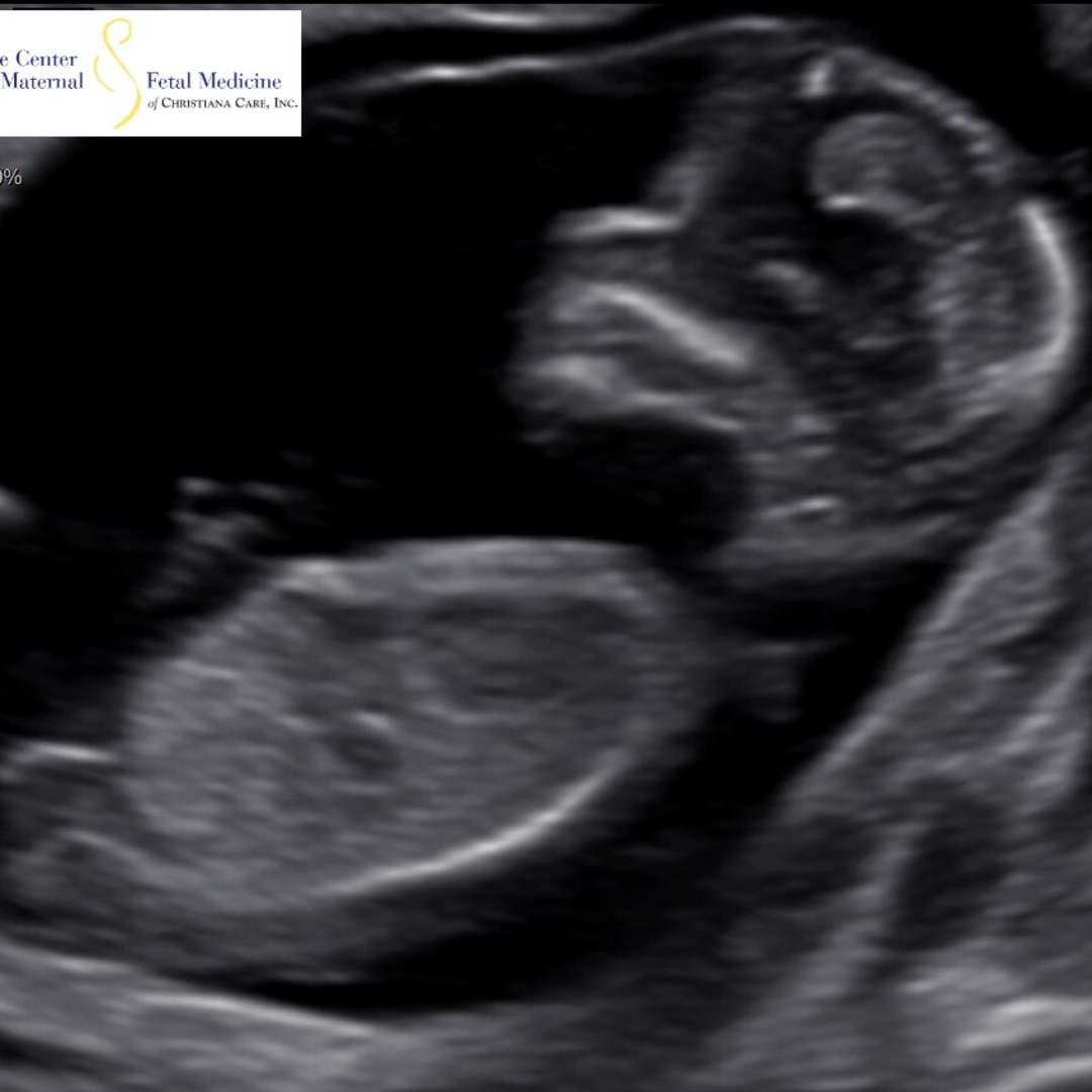 Photo shared by Lexi for their Babylist baby registry.