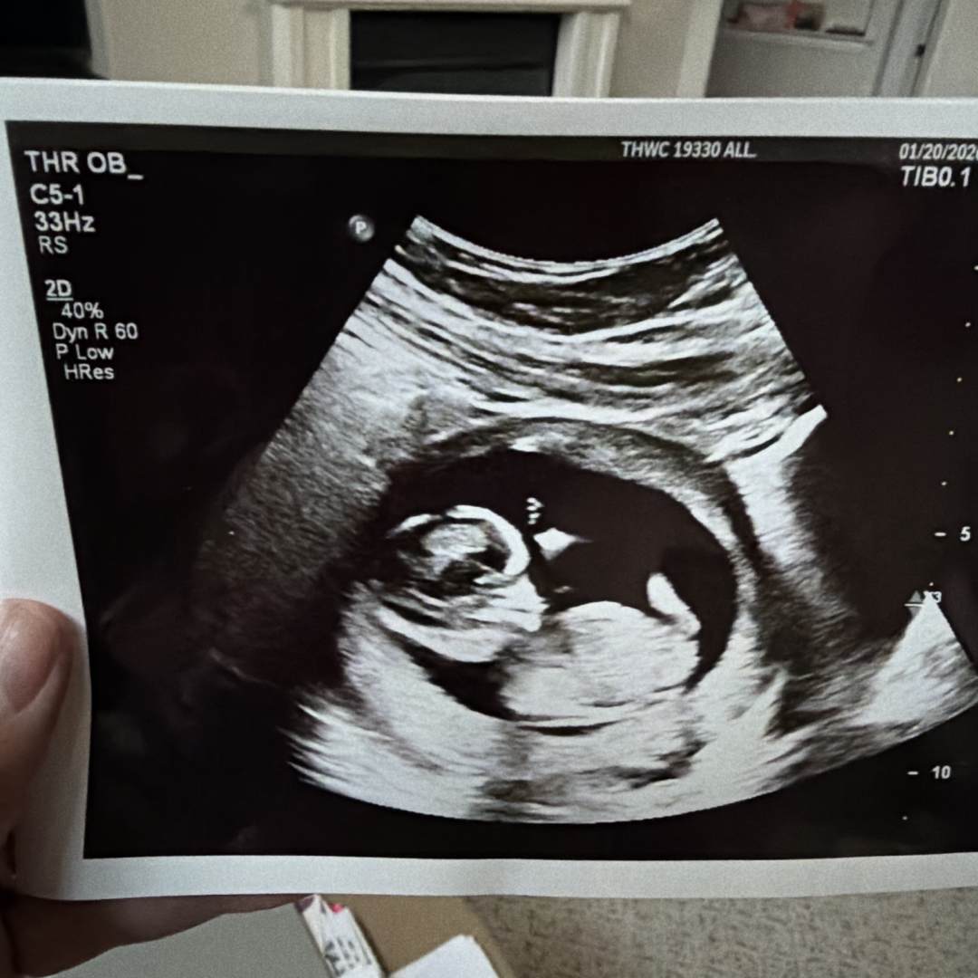 Photo shared by Ashley for their Babylist baby registry.