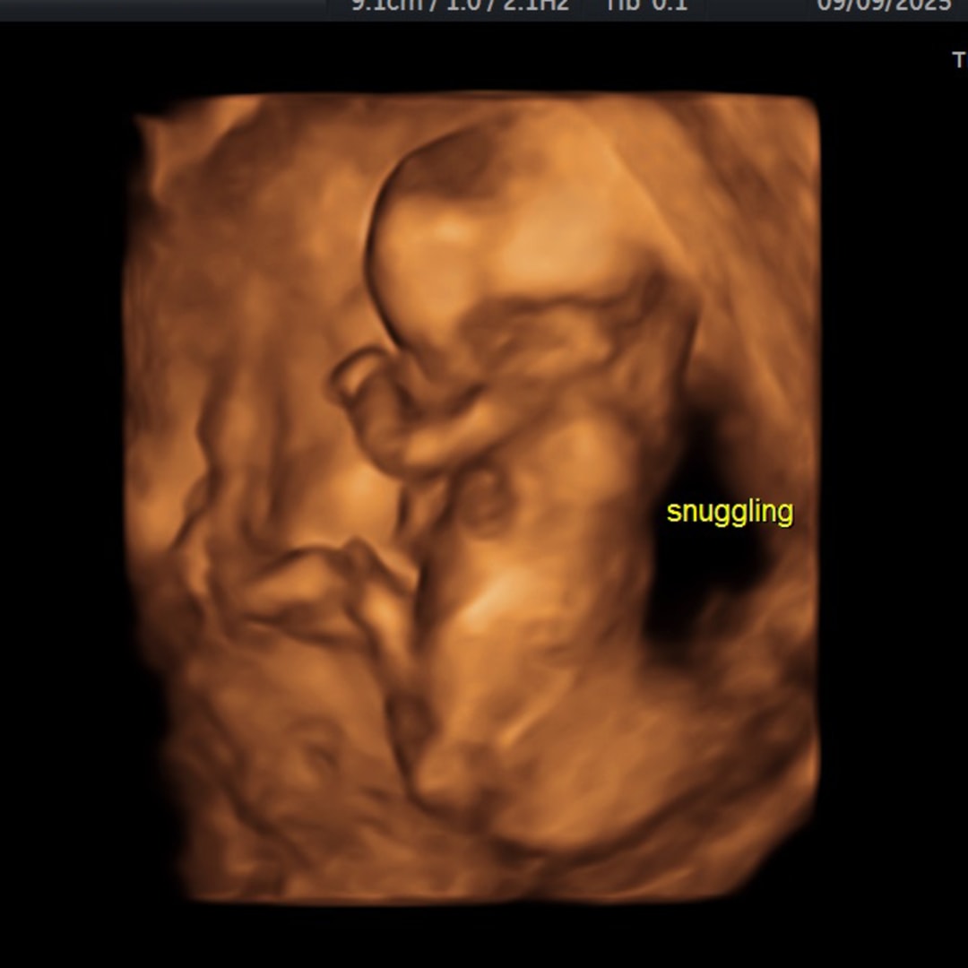 Photo shared by Dione for their Babylist baby registry.