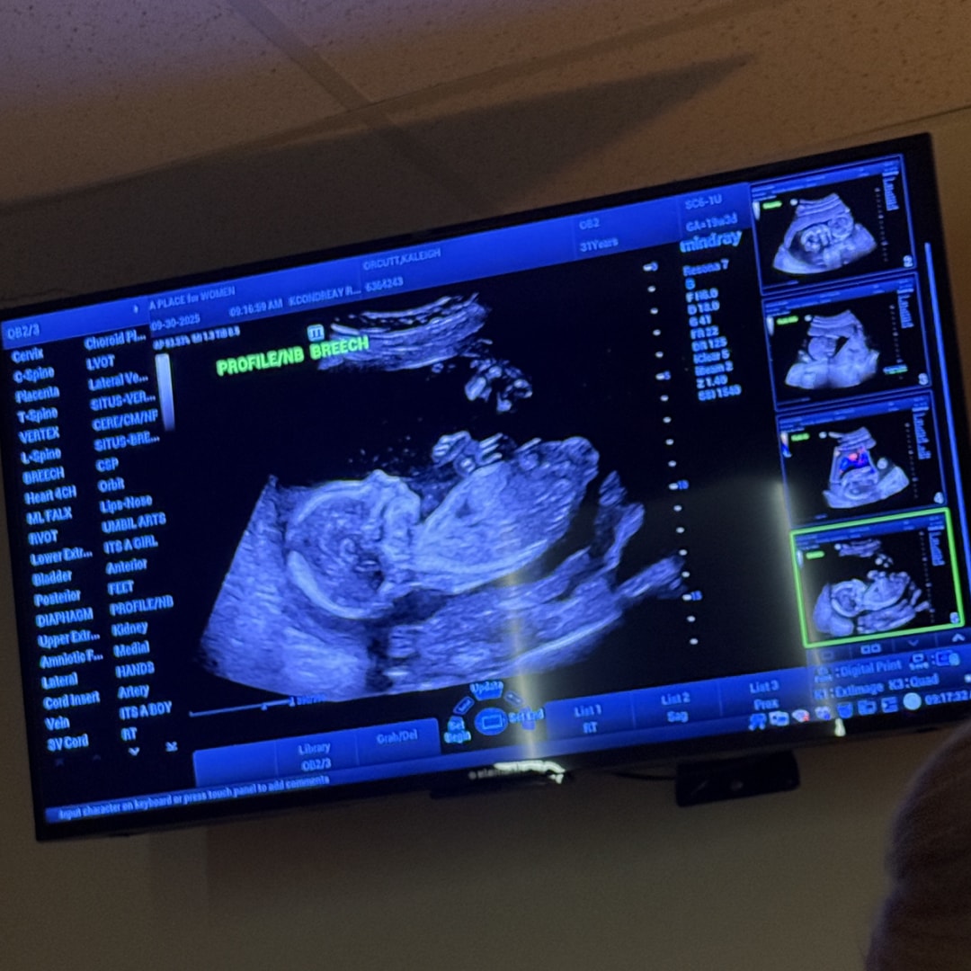 Photo shared by Kaleigh for their Babylist baby registry.