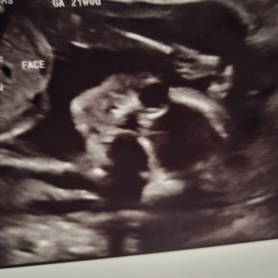 Photo shared by Desiree for their Babylist baby registry.