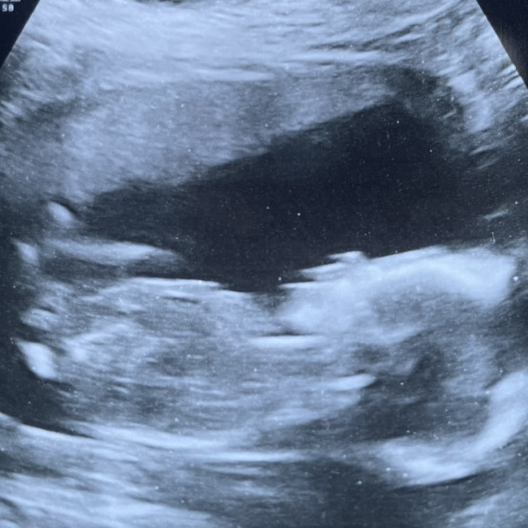 Photo shared by Jane for their Babylist baby registry.