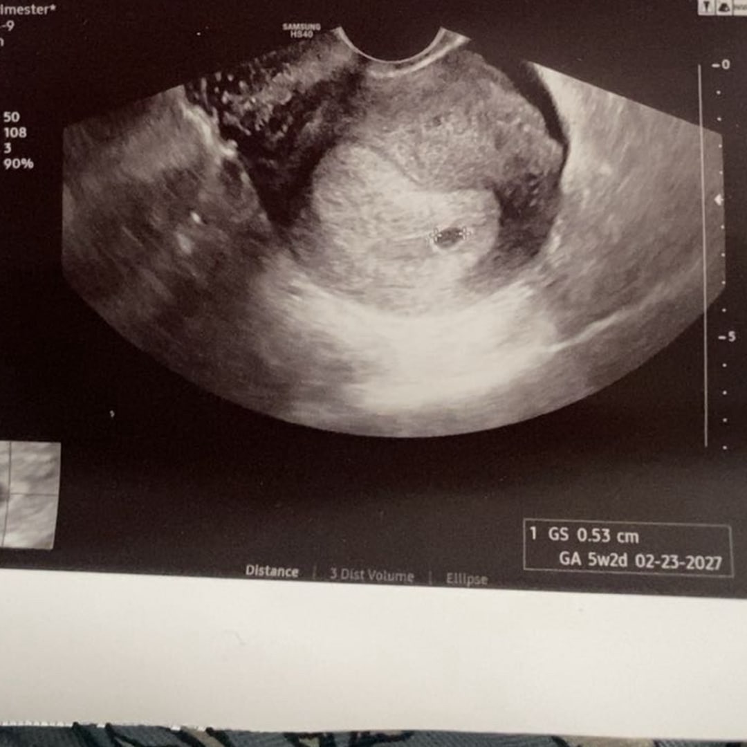 Photo shared by Brittany for their Babylist baby registry.