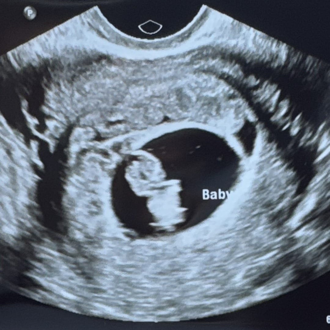 Photo shared by Olivia for their Babylist baby registry.