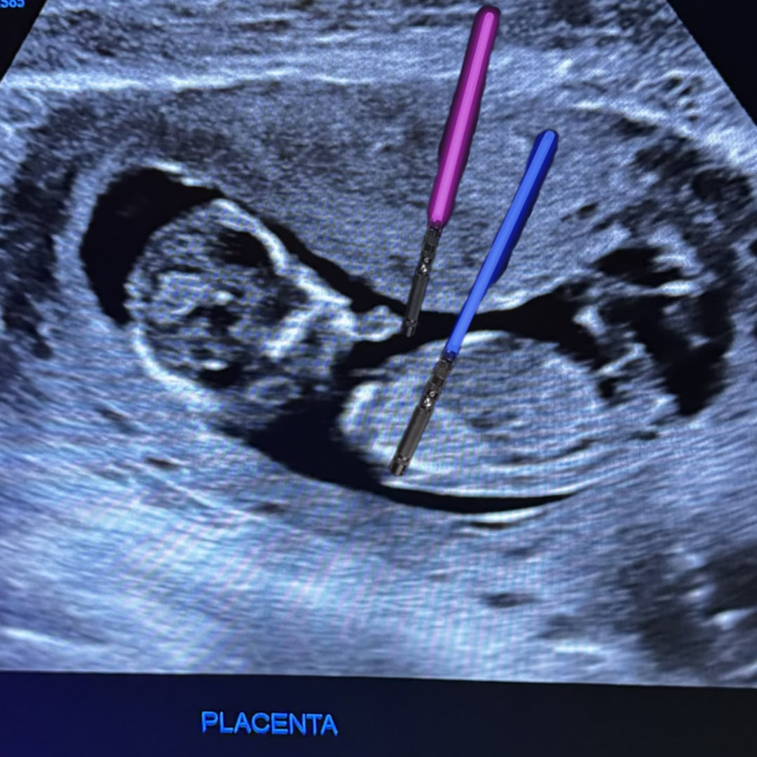 Photo shared by Ben for their Babylist baby registry.