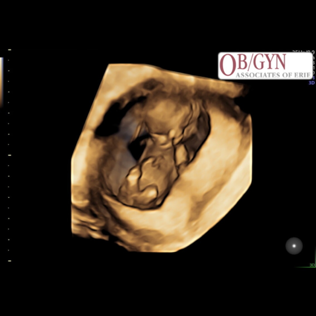 Photo shared by Amber for their Babylist baby registry.