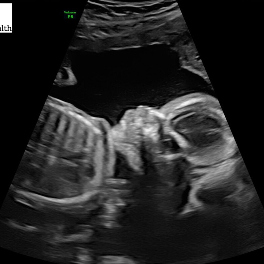 Photo shared by Chassie for their Babylist baby registry.