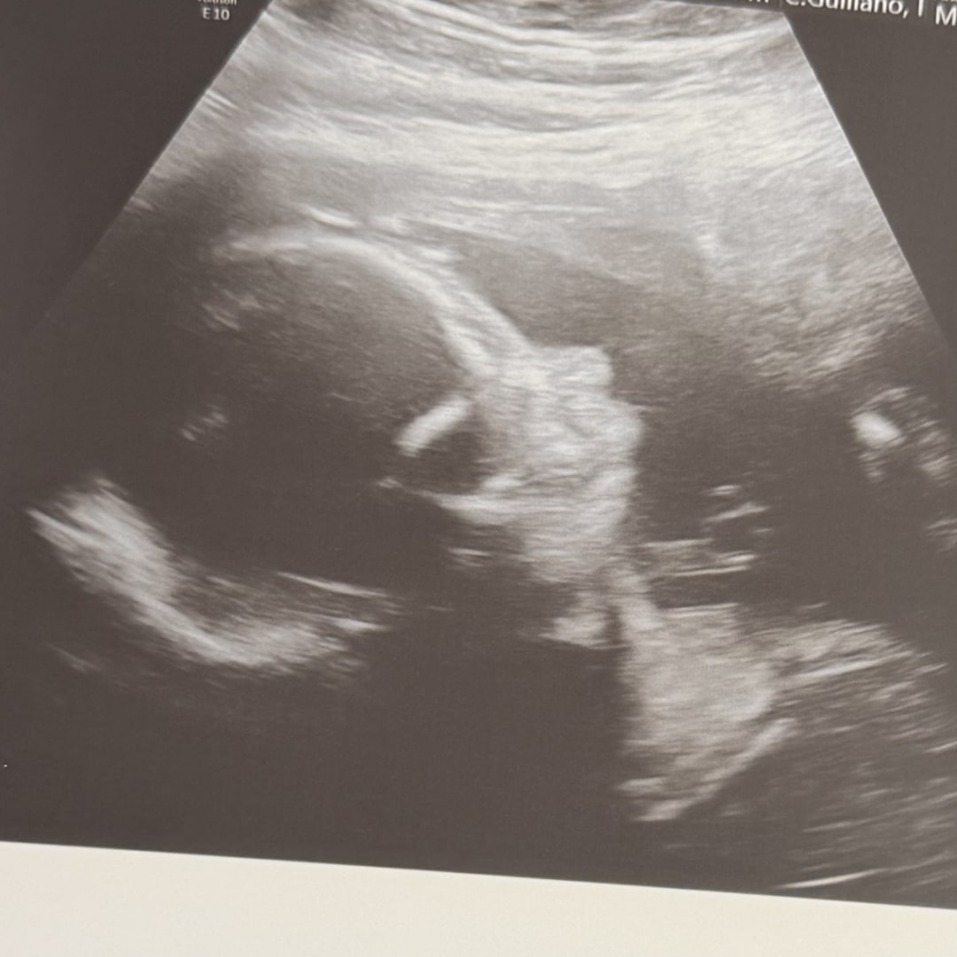 Photo shared by Alyssa for their Babylist baby registry.