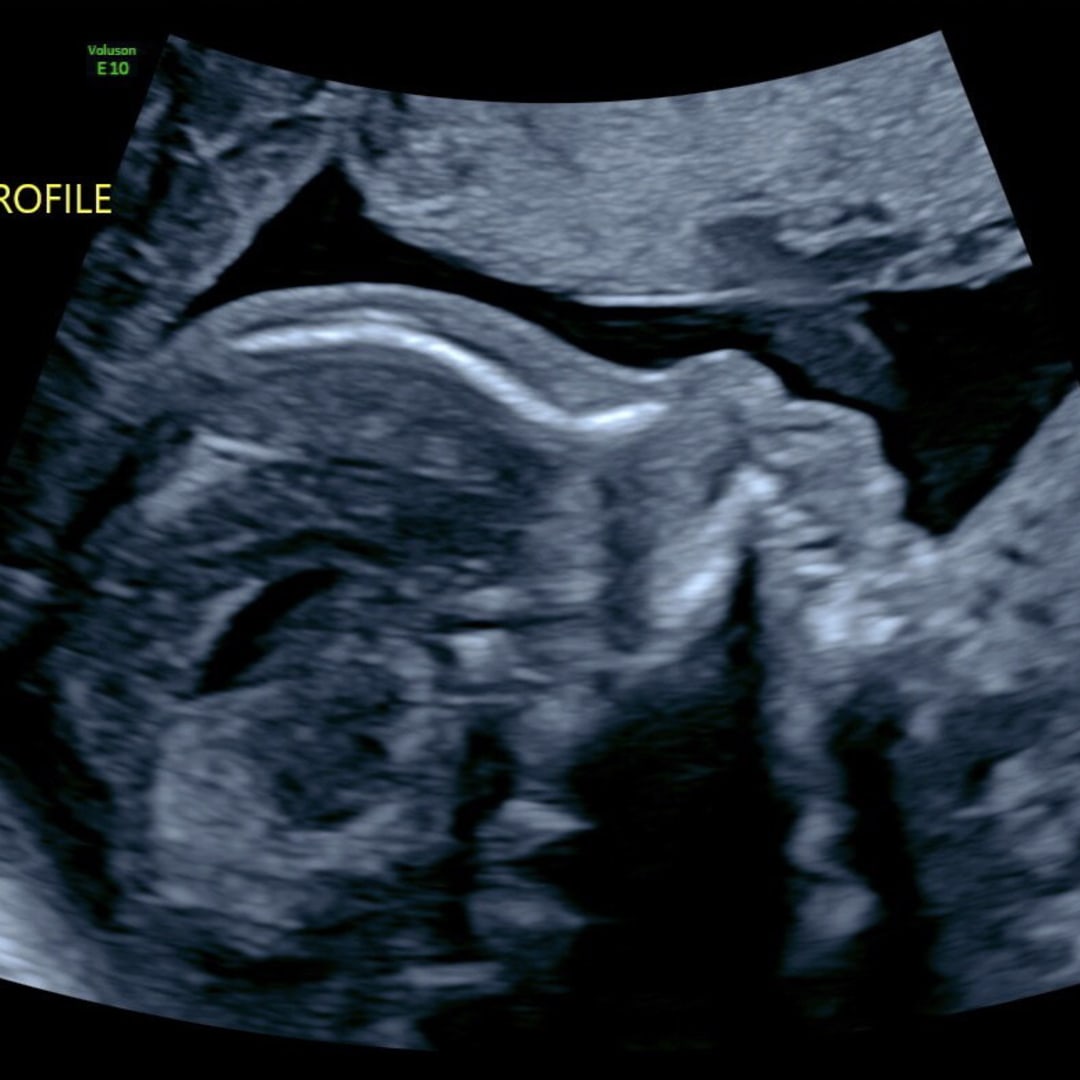 Photo shared by Ashby for their Babylist baby registry.