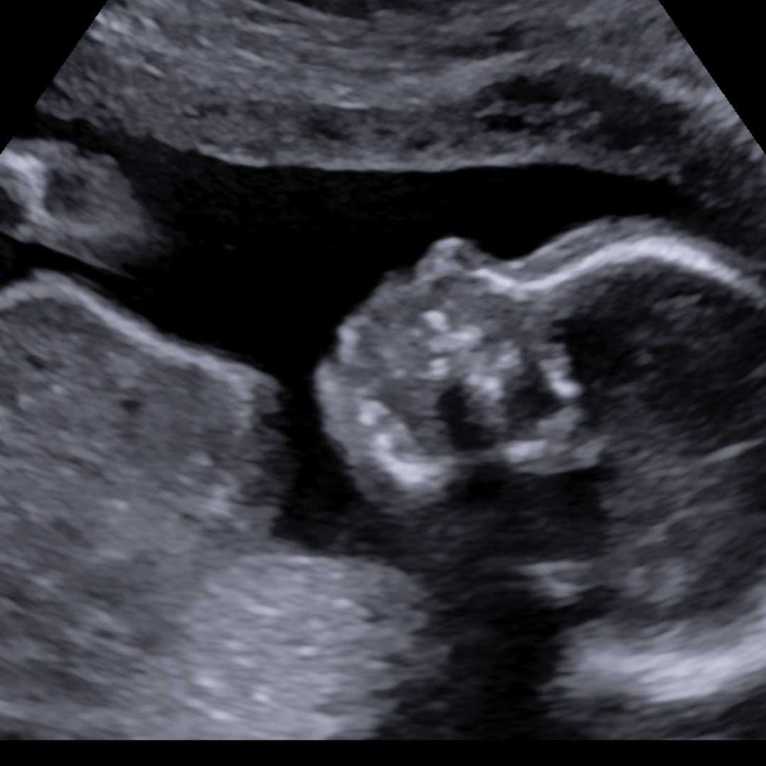 Photo shared by Brooklyn for their Babylist baby registry.