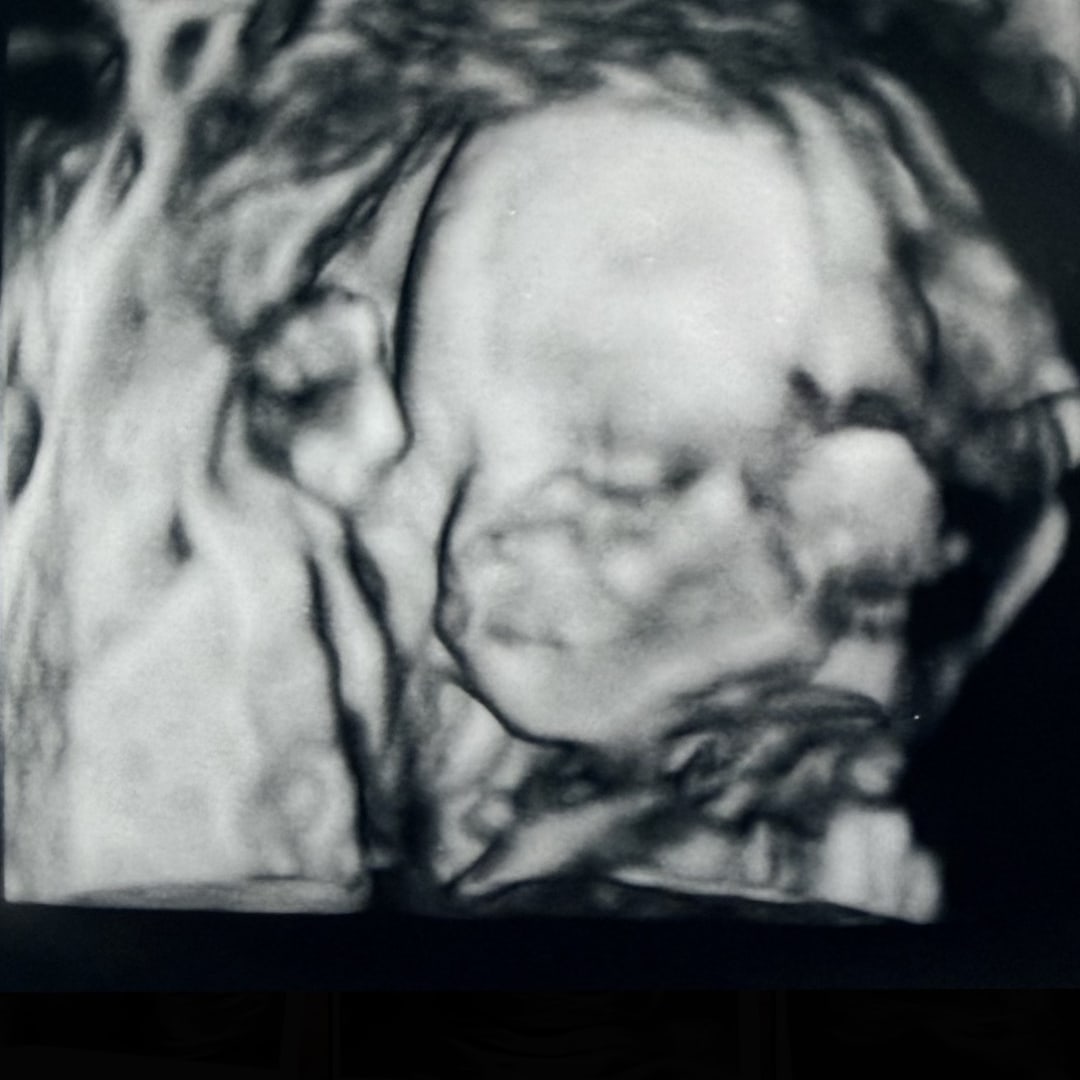 Photo shared by Brett Leigh for their Babylist baby registry.