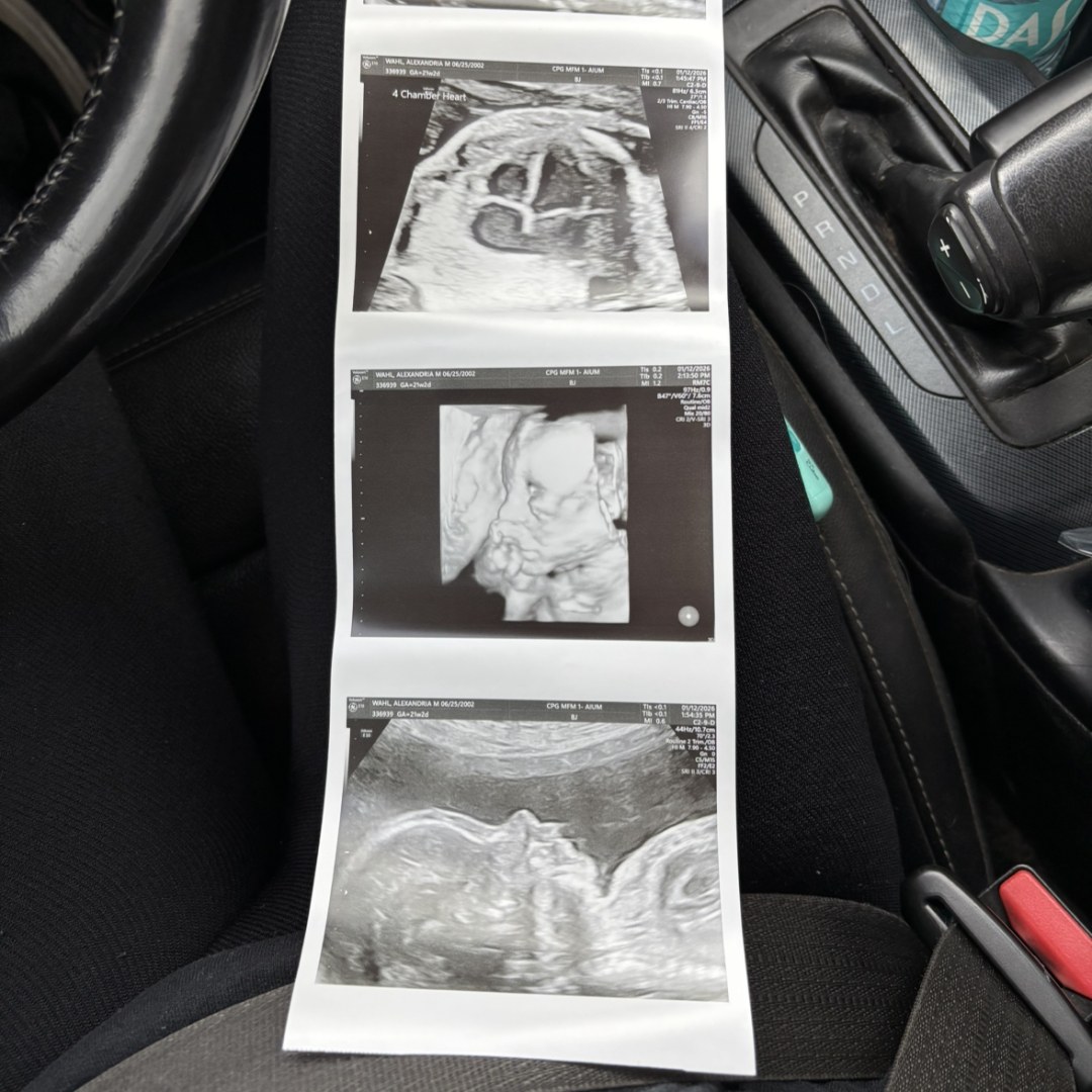 Photo shared by Alexandria for their Babylist baby registry.