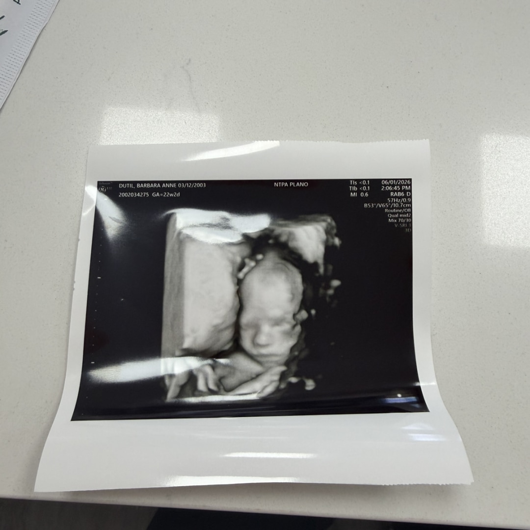 Photo shared by Barbara for their Babylist baby registry.