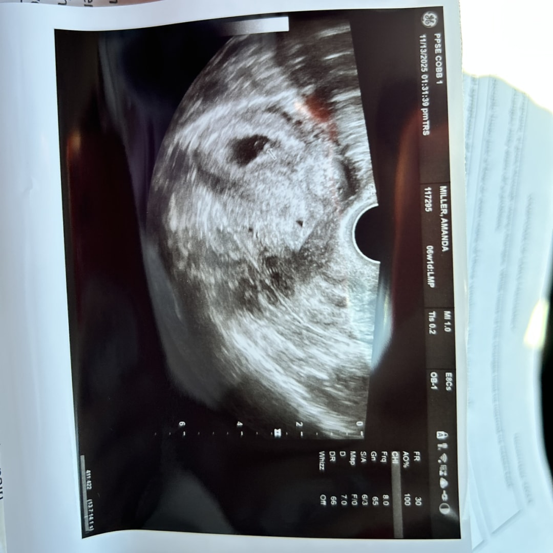 Photo shared by Amanda for their Babylist baby registry.