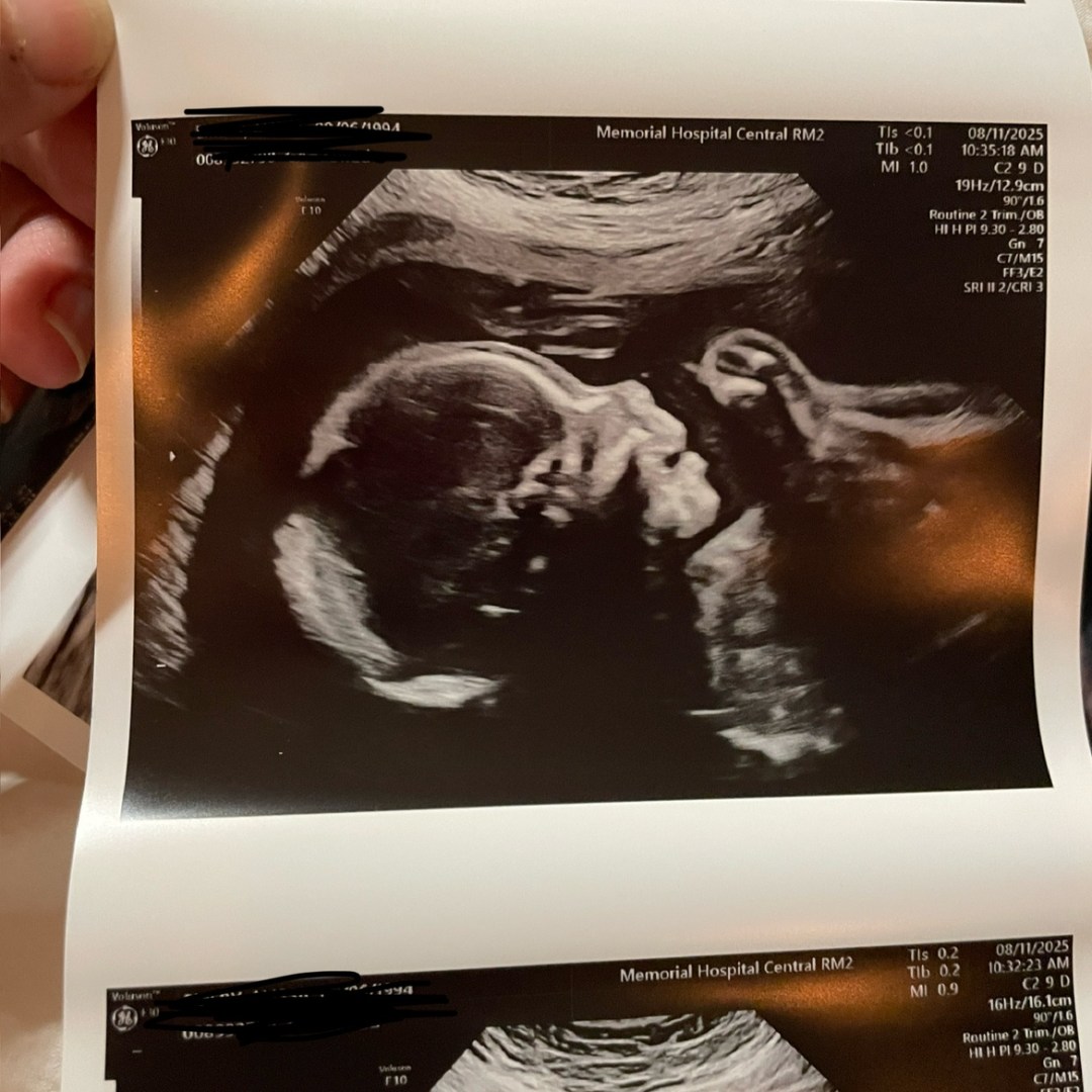 Photo shared by Katie for their Babylist baby registry.