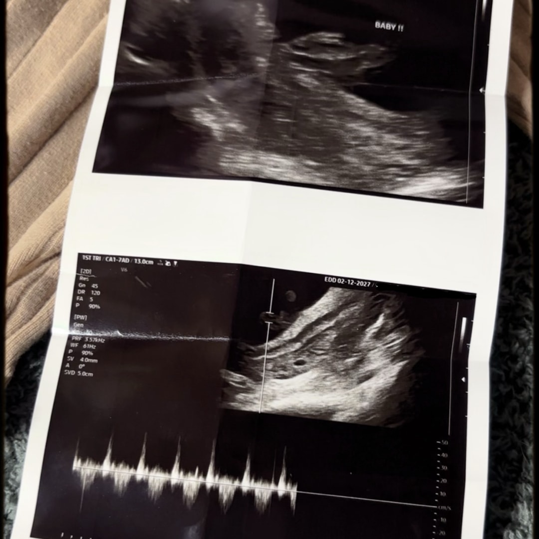 Photo shared by Desiree for their Babylist baby registry.