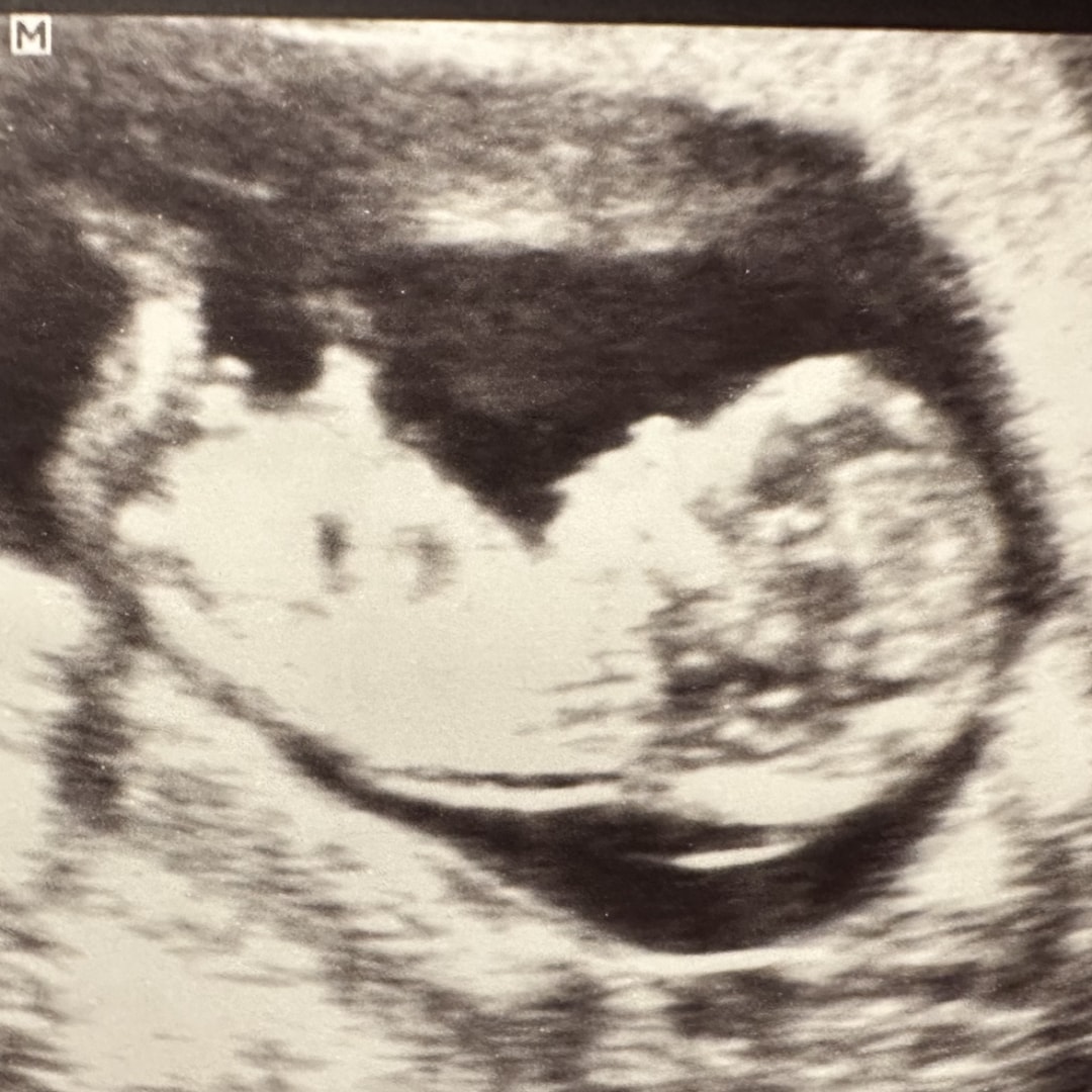 Photo shared by Micaela for their Babylist baby registry.
