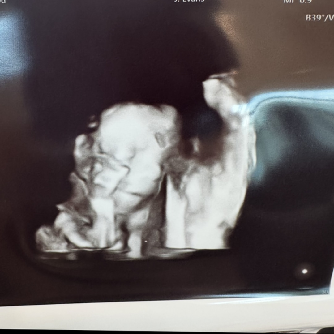 Photo shared by Ashley for their Babylist baby registry.