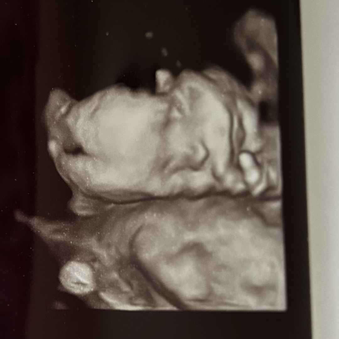 Photo shared by Elizabeth for their Babylist baby registry.