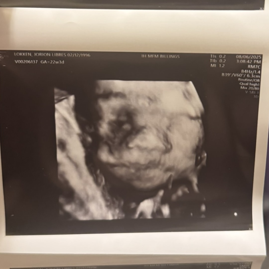 Photo shared by Jorion for their Babylist baby registry.