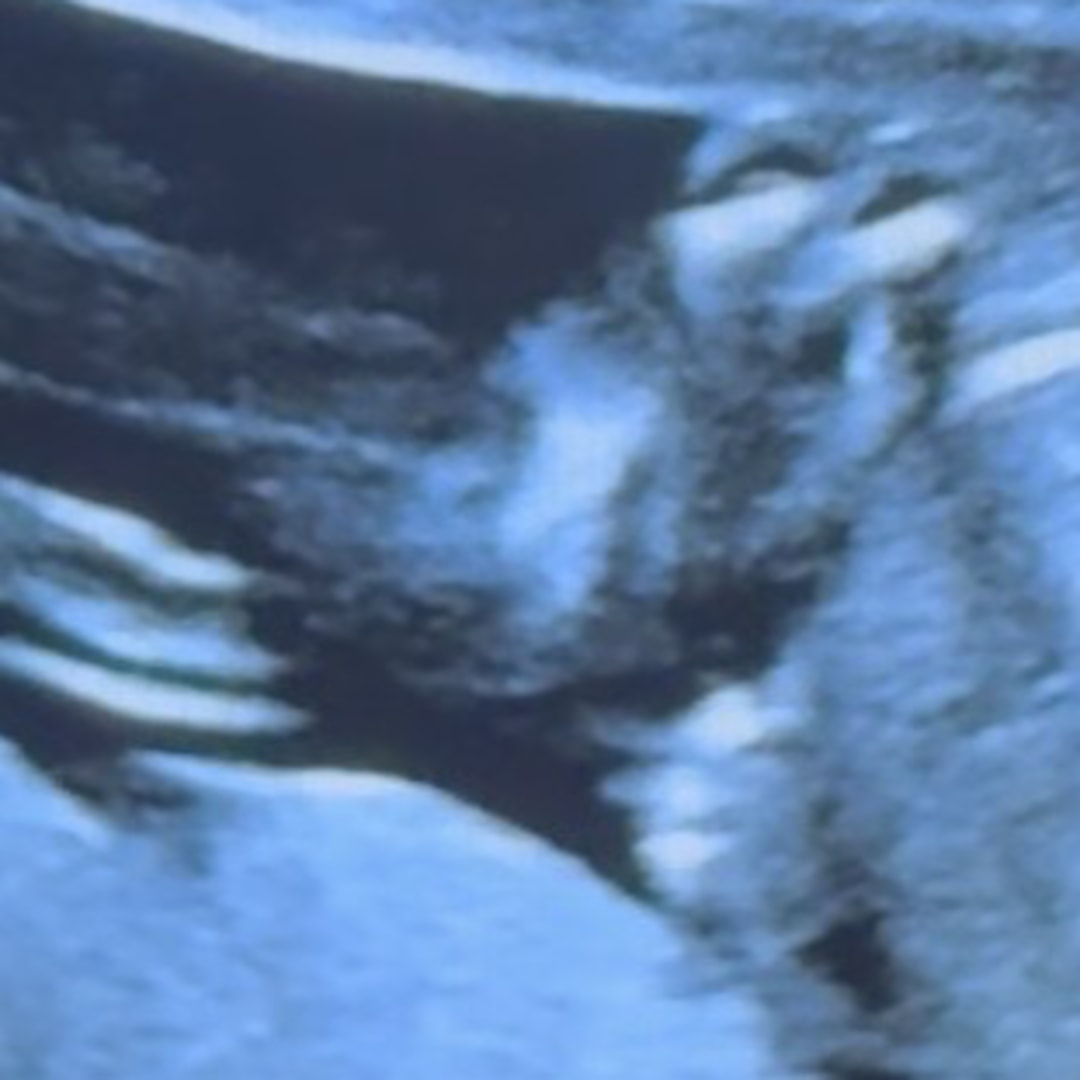 Photo shared by Regan for their Babylist baby registry.