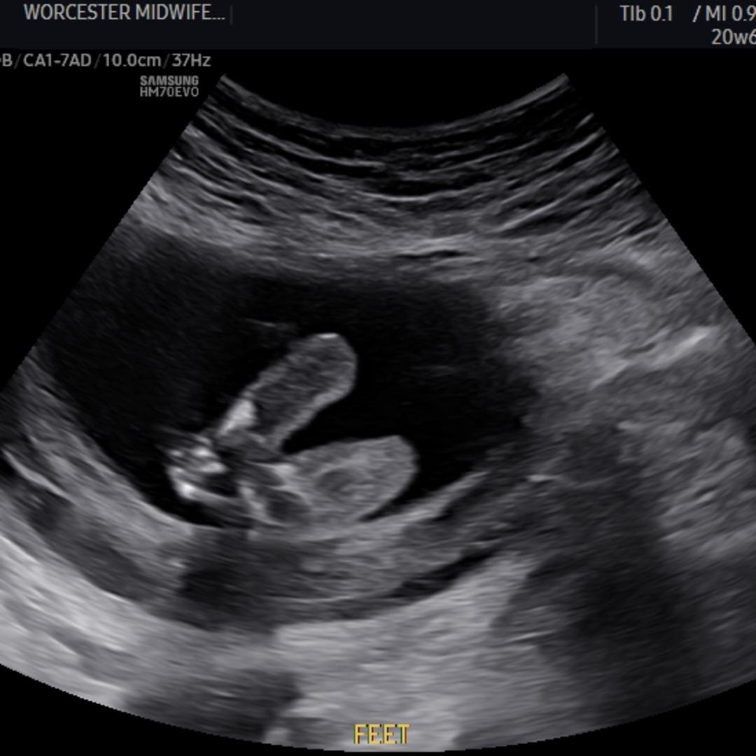 Photo shared by Lisa for their Babylist baby registry.