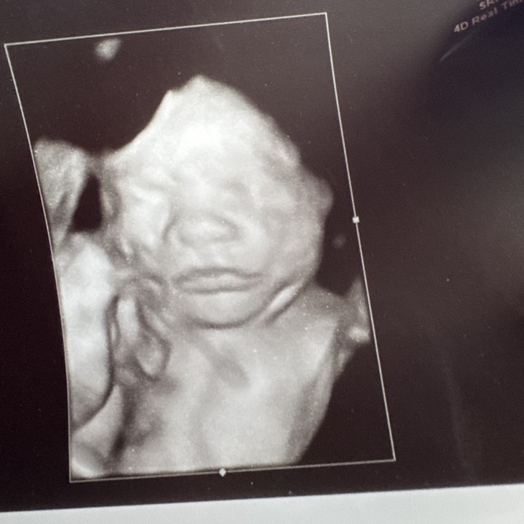 Photo shared by Mary for their Babylist baby registry.