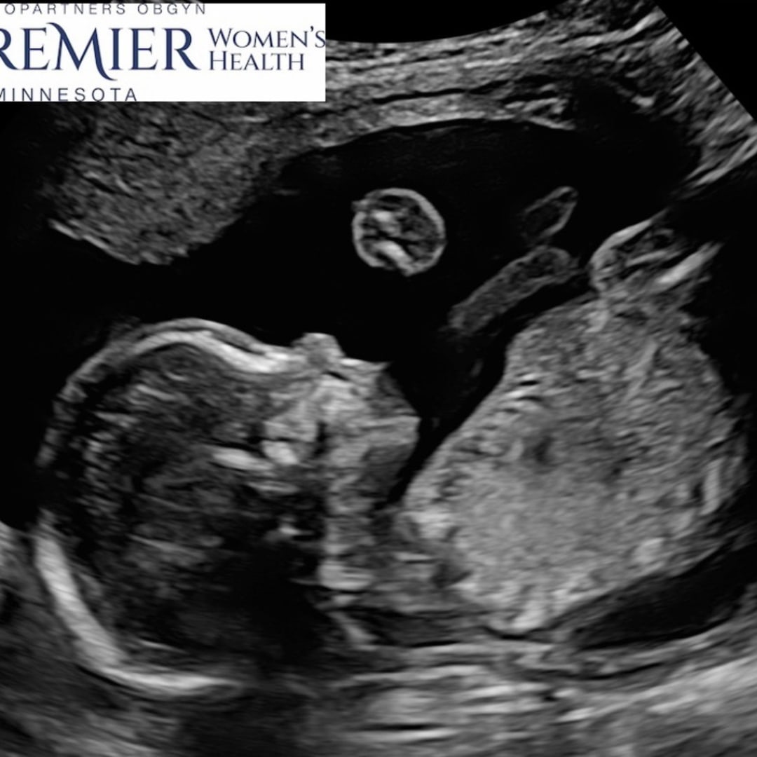 Photo shared by Aubrey for their Babylist baby registry.