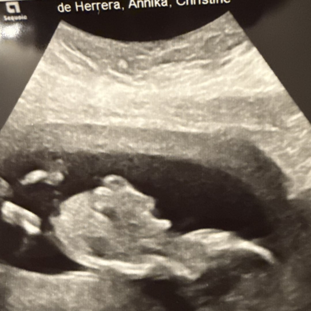 Photo shared by Annika for their Babylist baby registry.