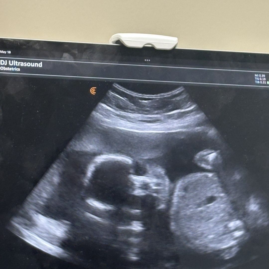 Photo shared by Erik for their Babylist baby registry.