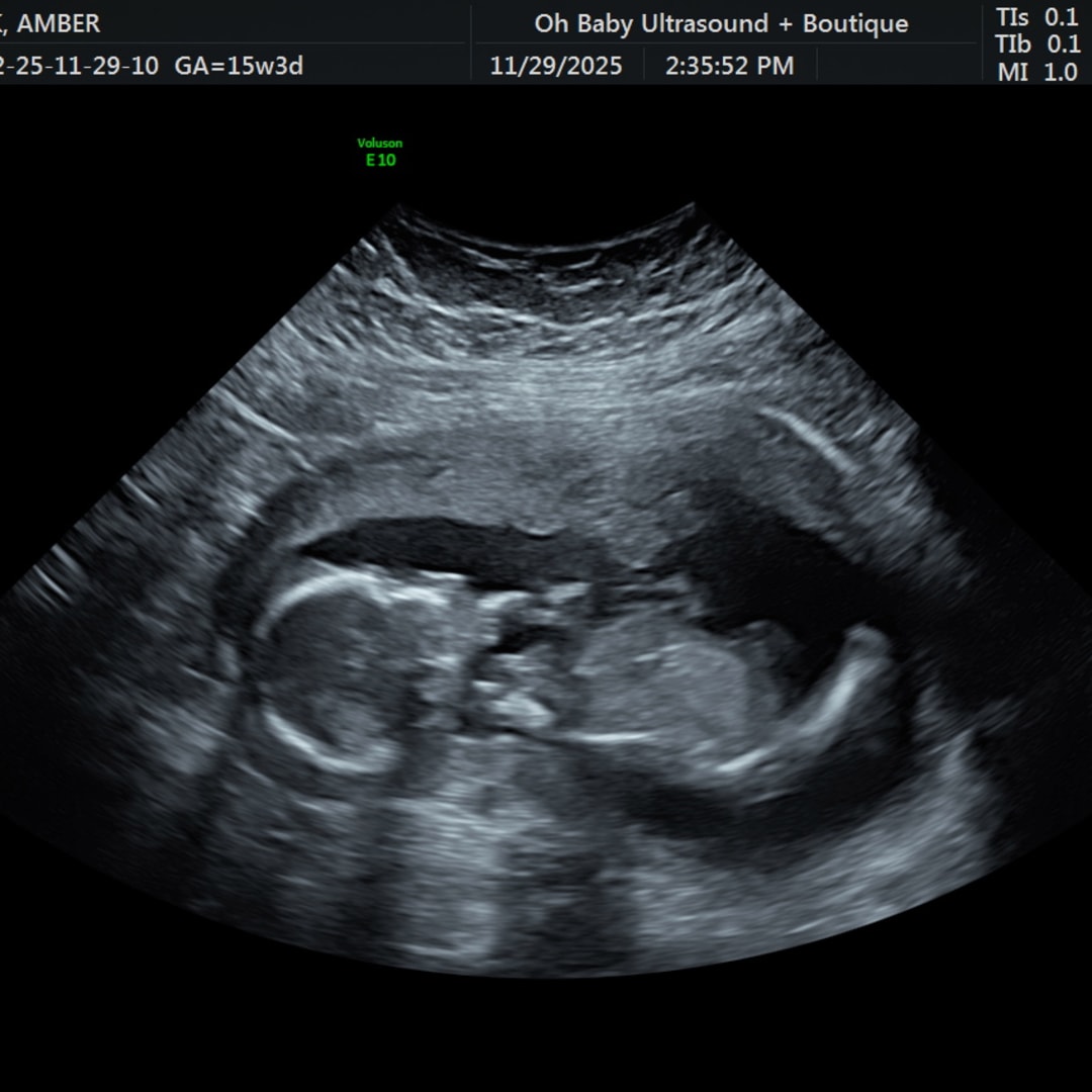 Photo shared by Amber and Morghen for their Babylist baby registry.