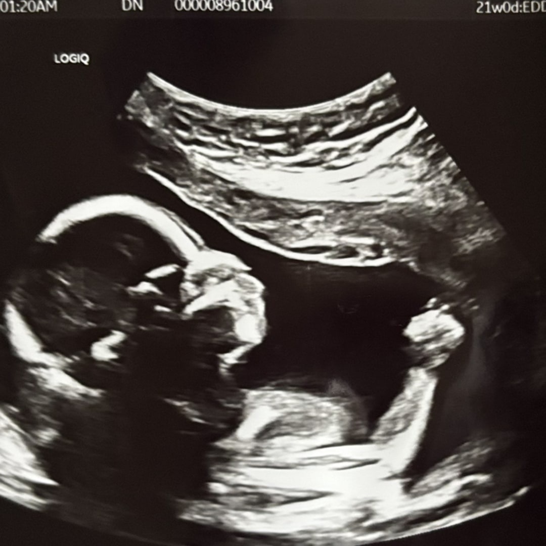 Photo shared by Josh for their Babylist baby registry.