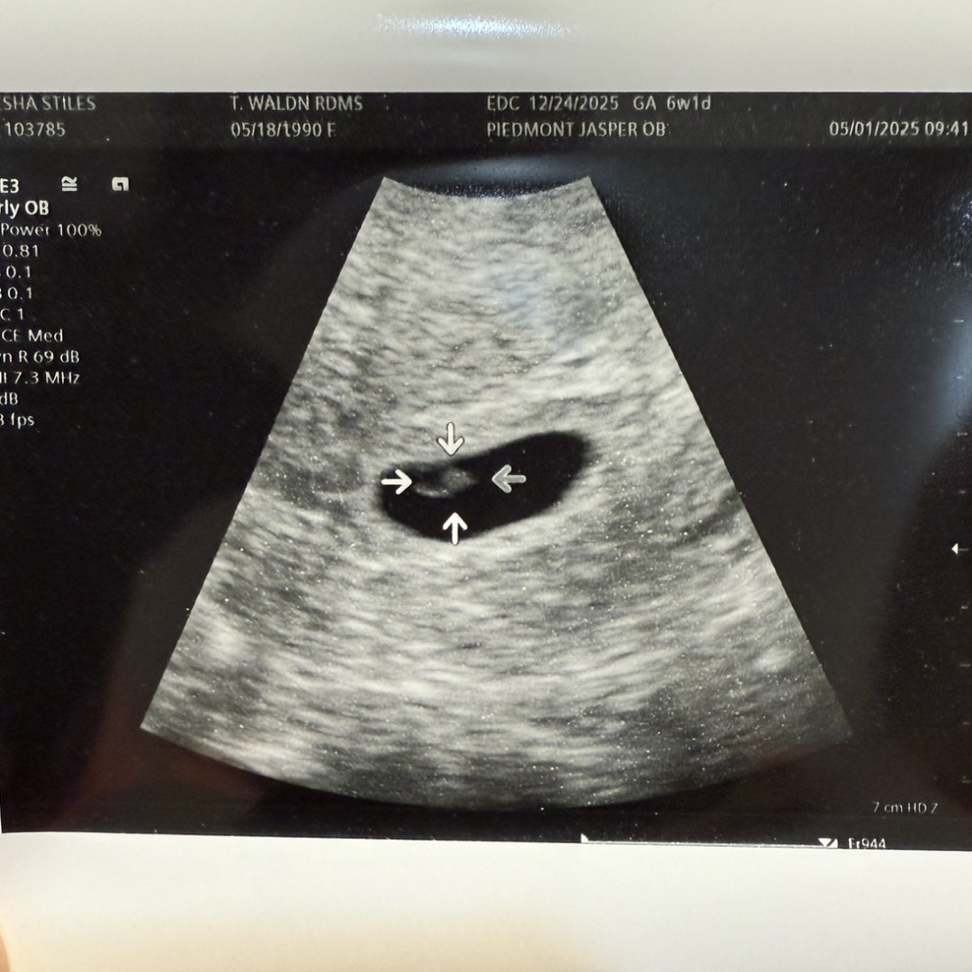 Photo shared by Alesha for their Babylist baby registry.