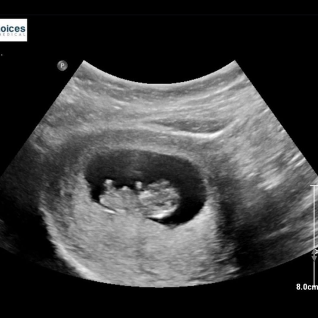 Photo shared by Alexis for their Babylist baby registry.