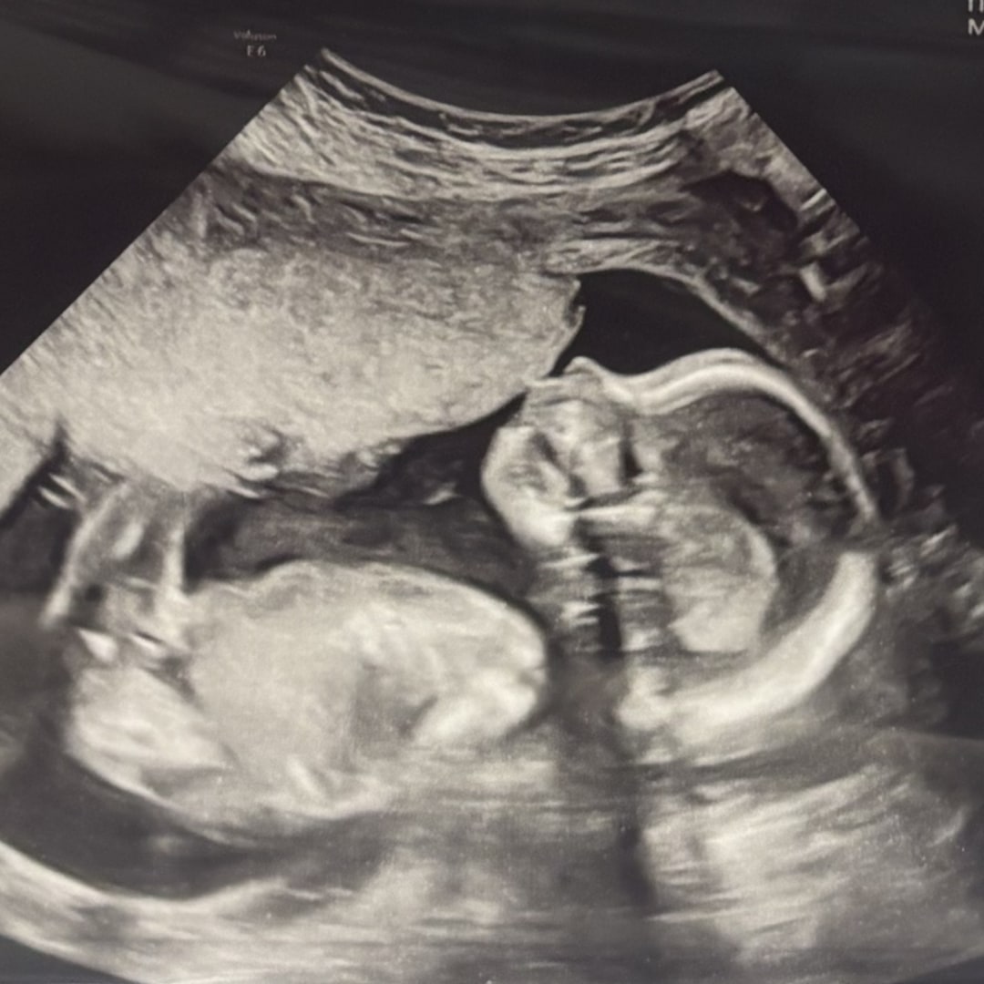 Photo shared by Rachel for their Babylist baby registry.