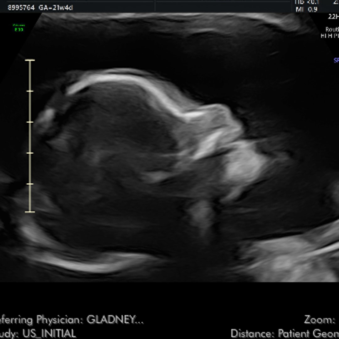 Photo shared by Ashlynn for their Babylist baby registry.