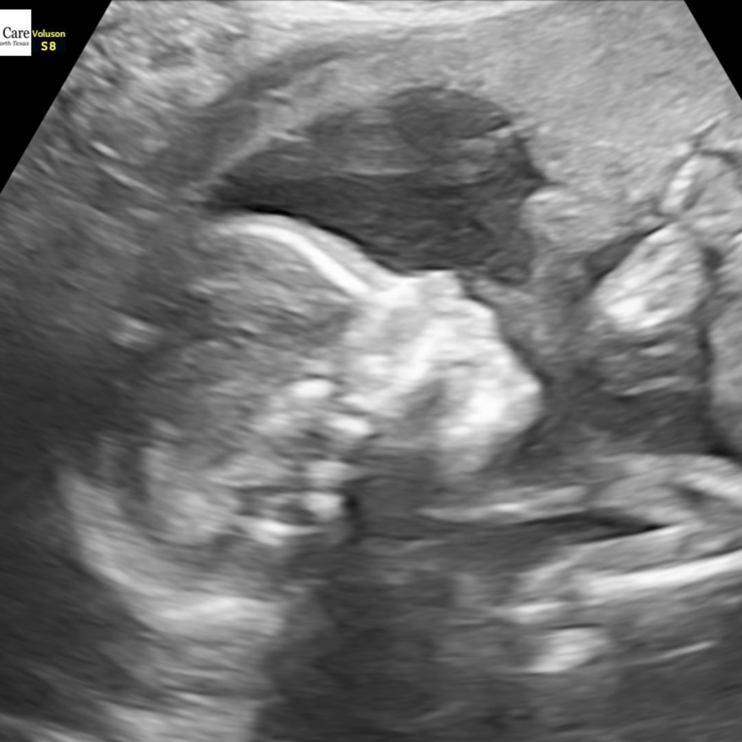 Photo shared by Caylen for their Babylist baby registry.