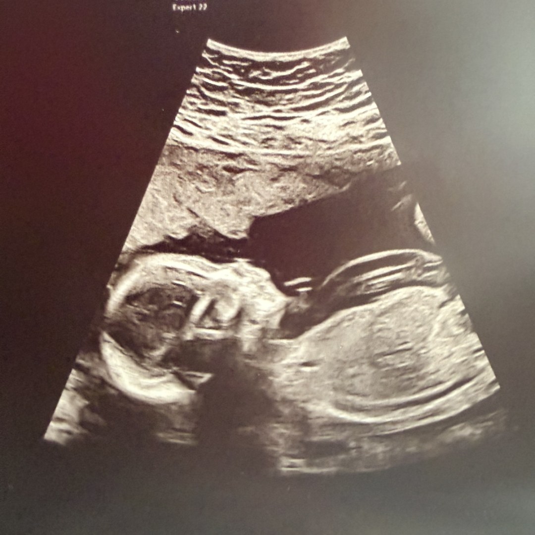 Photo shared by Erika for their Babylist baby registry.