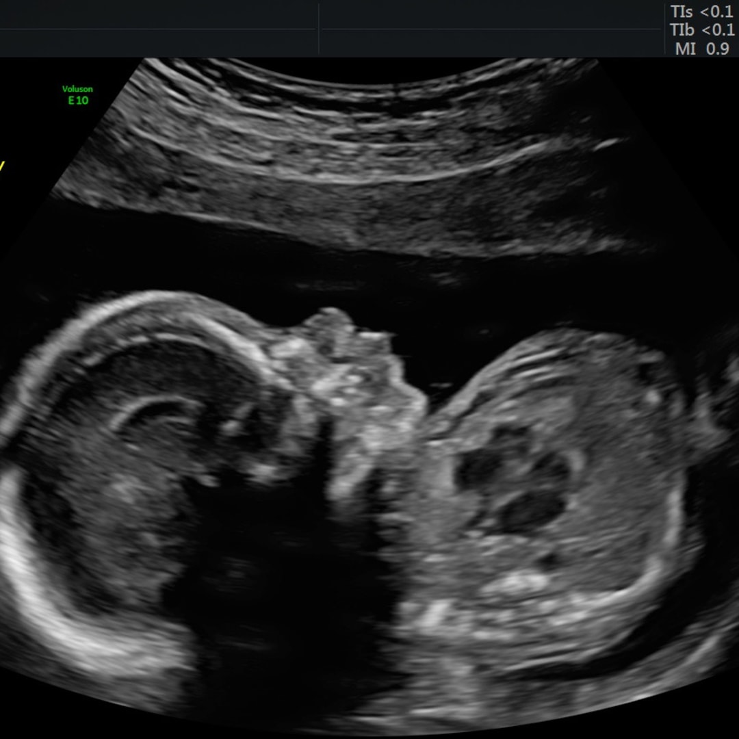 Photo shared by Tre & Kae for their Babylist baby registry.