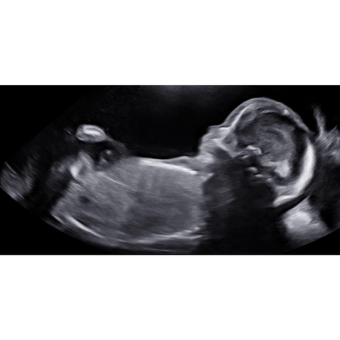 Photo shared by Charlotte for their Babylist baby registry.