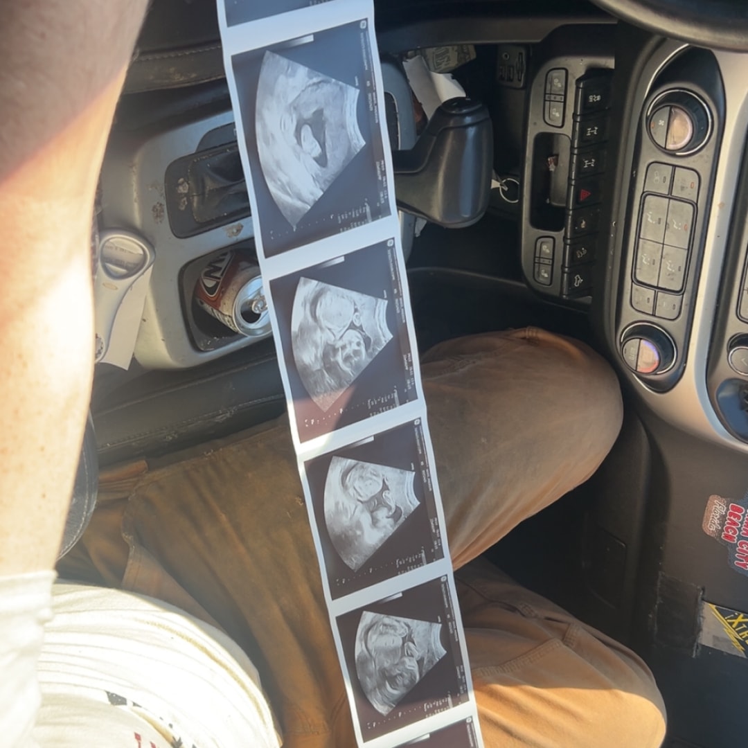 Photo shared by Madison for their Babylist baby registry.