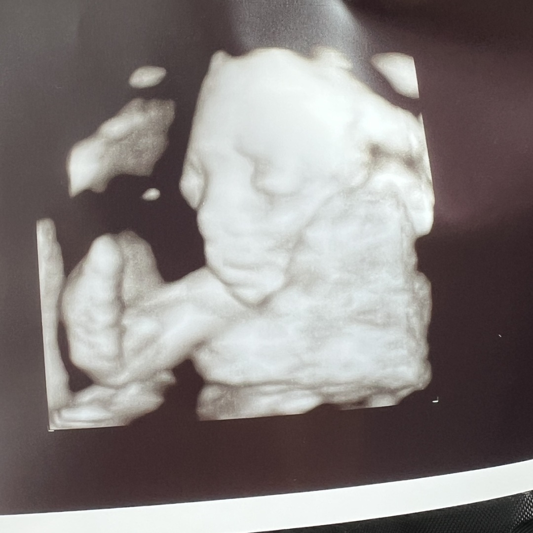 Photo shared by Maria for their Babylist baby registry.