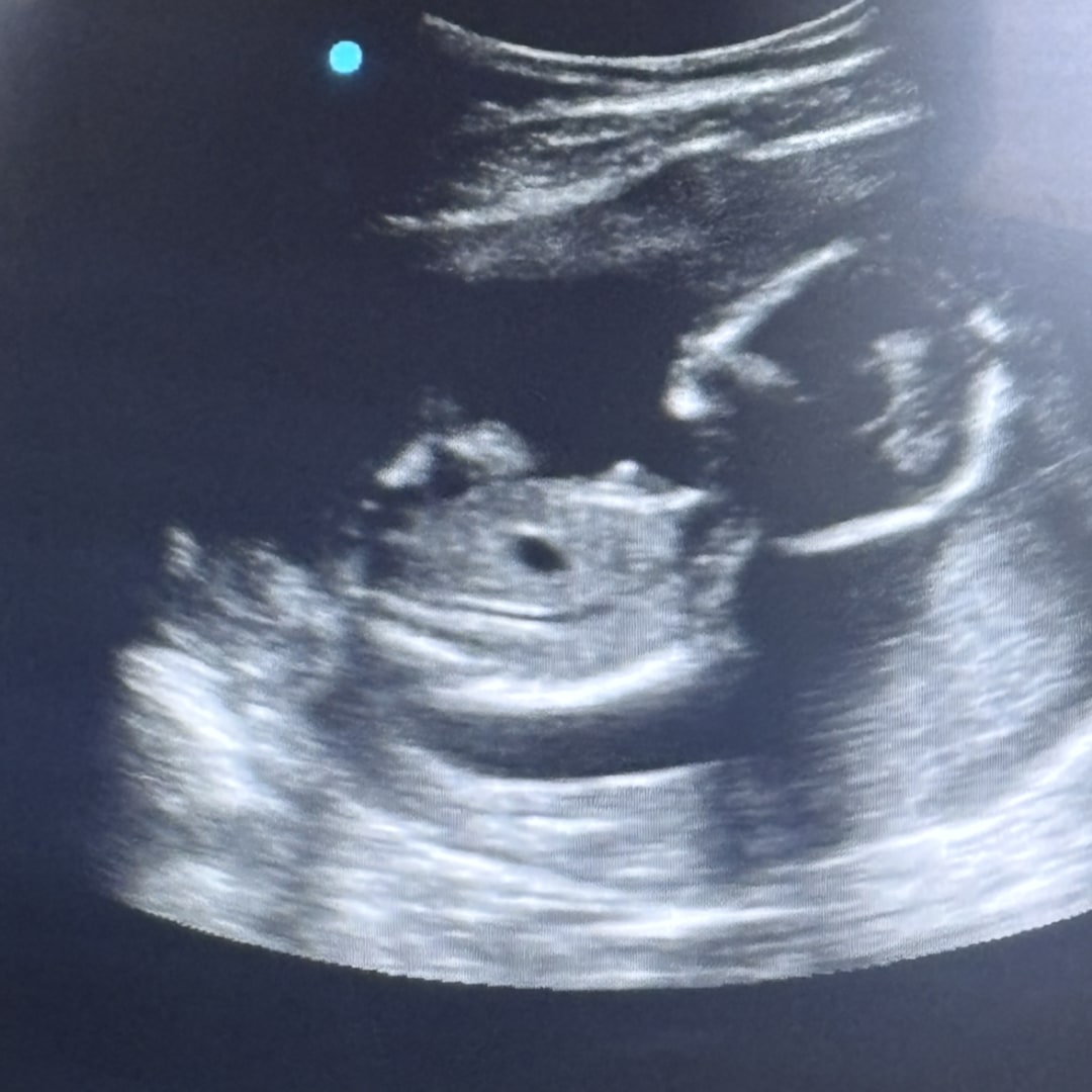 Photo shared by Jamie for their Babylist baby registry.