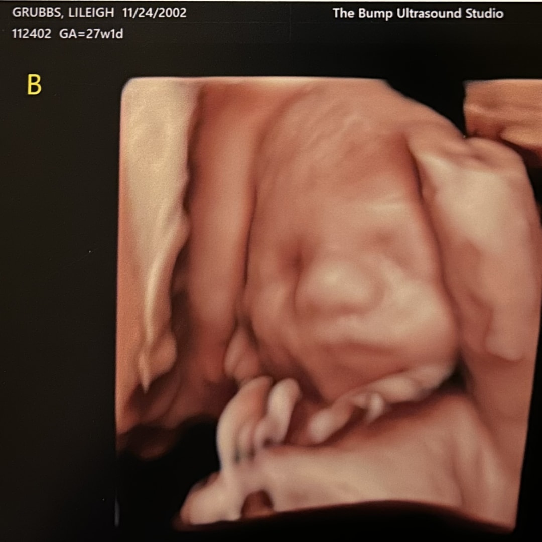 Photo shared by Lileigh for their Babylist baby registry.