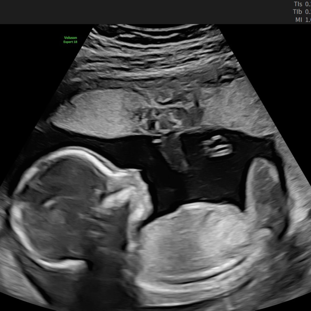 Photo shared by Rebecca for their Babylist baby registry.