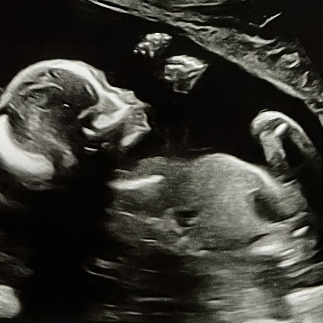 Photo shared by Rachel for their Babylist baby registry.