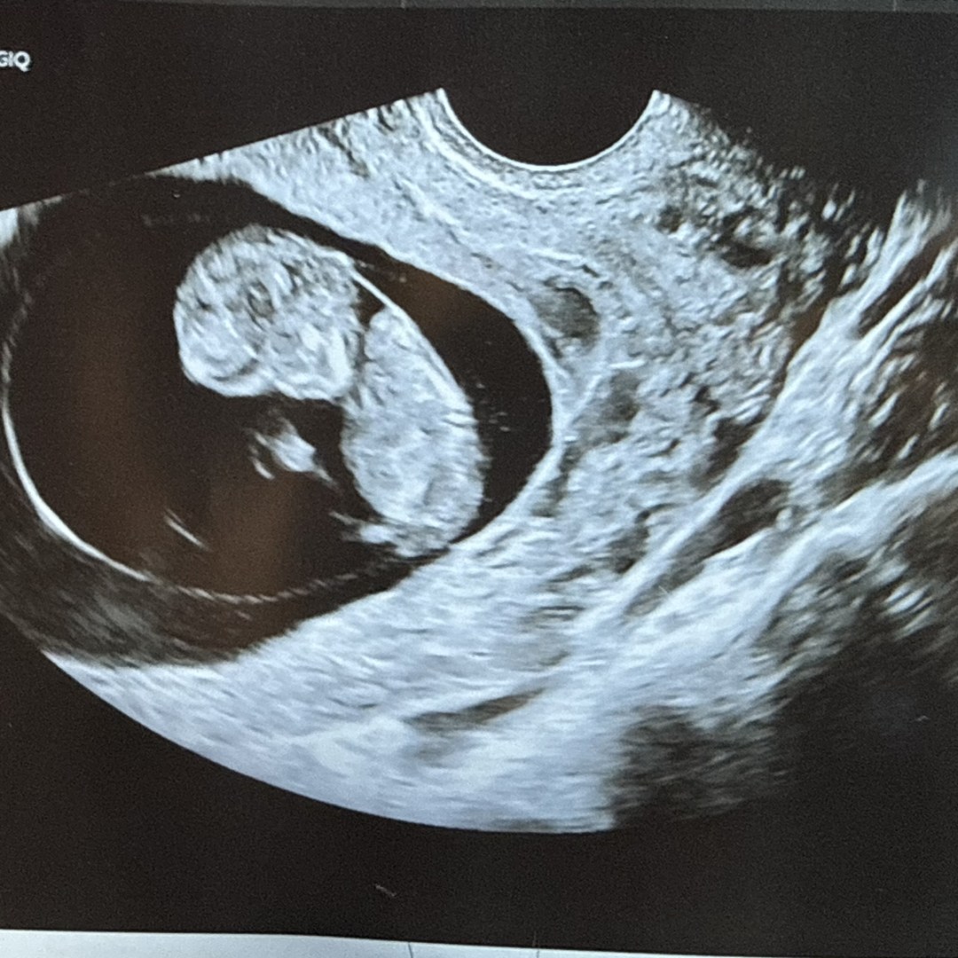 Photo shared by Kaydence for their Babylist baby registry.