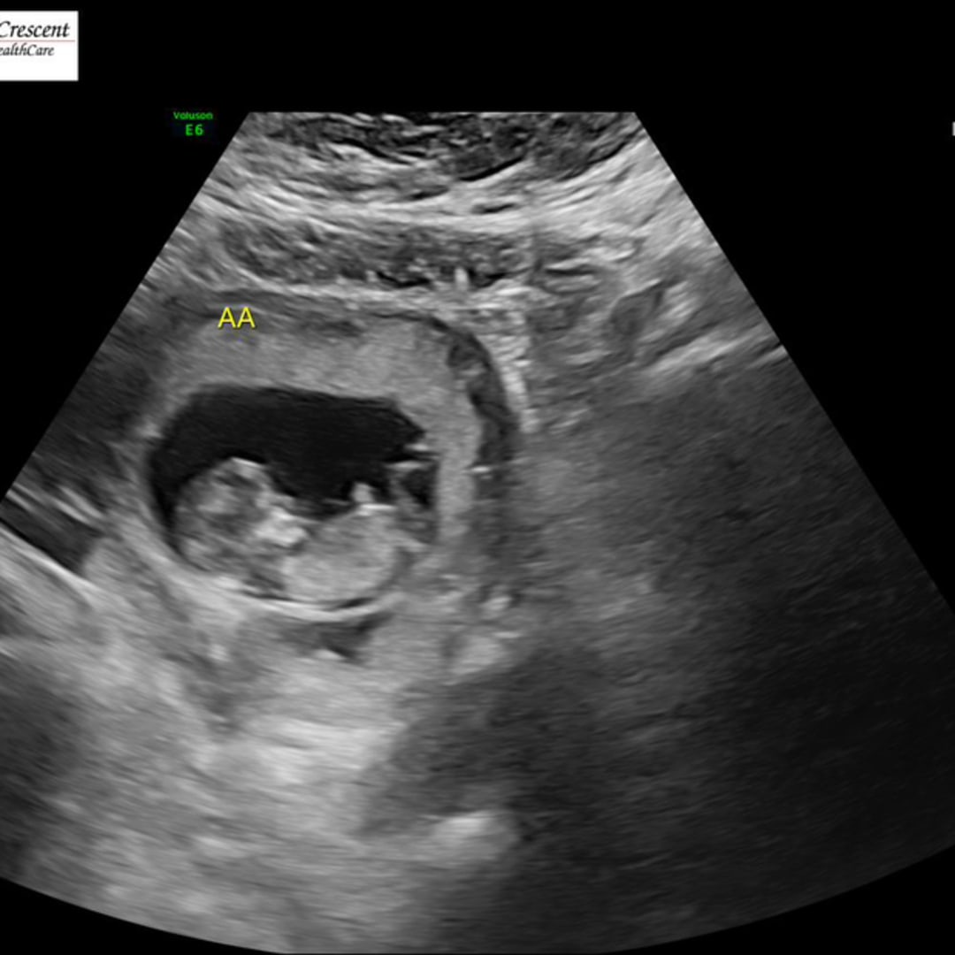 Photo shared by Georgina for their Babylist baby registry.