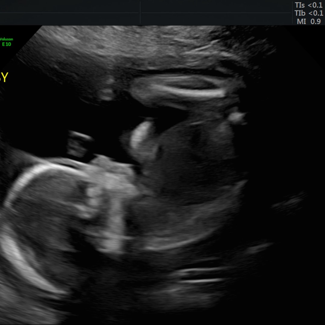 Photo shared by Megan for their Babylist baby registry.